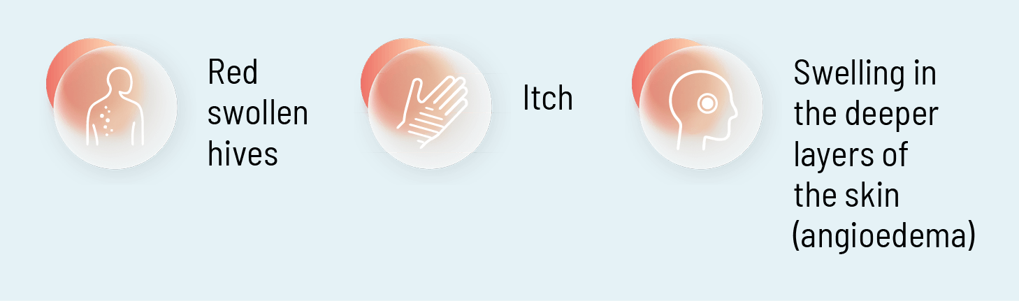 What is hives (urticaria)?